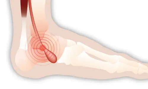 Kelowna Kinesiology By Orthoquest