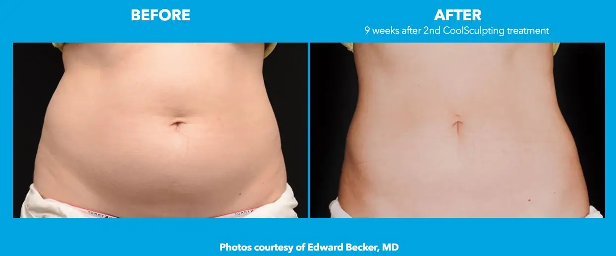 Medisculpt Klinic