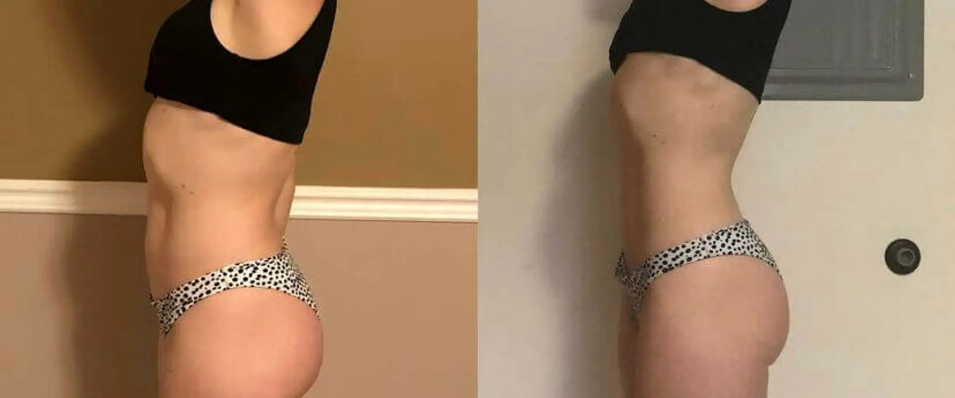 B Elite "Experts in Stress-Reduced Fat Loss"