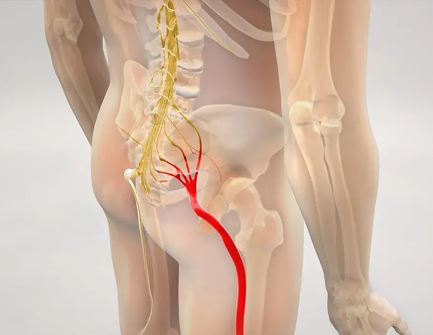Physio Clondalkin - DC Physiotherapy