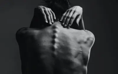 Balanced Bodies: Injury Rehabilitation (Ropley)