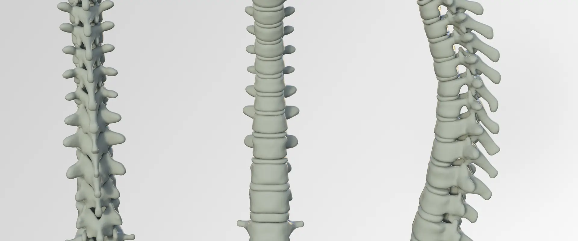 SpineX Clinic, Physiotherapy Center & Pain Management Clinic