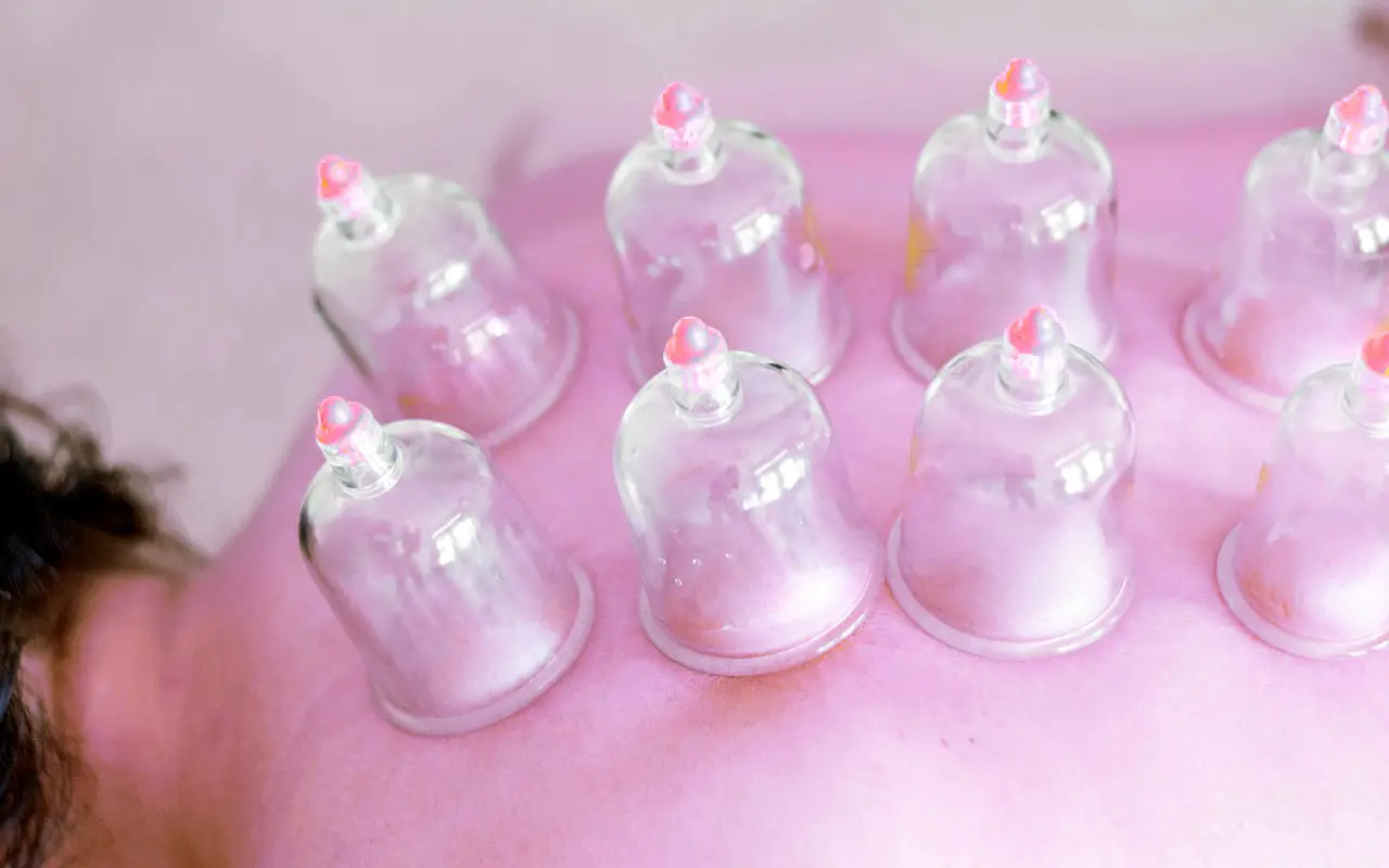 Female Fitness Trainer - Hijama Cupping Therapy