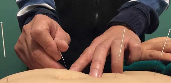 Peter Chen Acupuncture