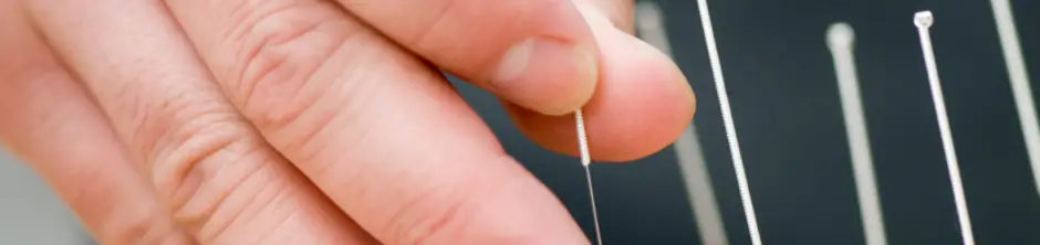 The Art Of Harmony Acupuncture