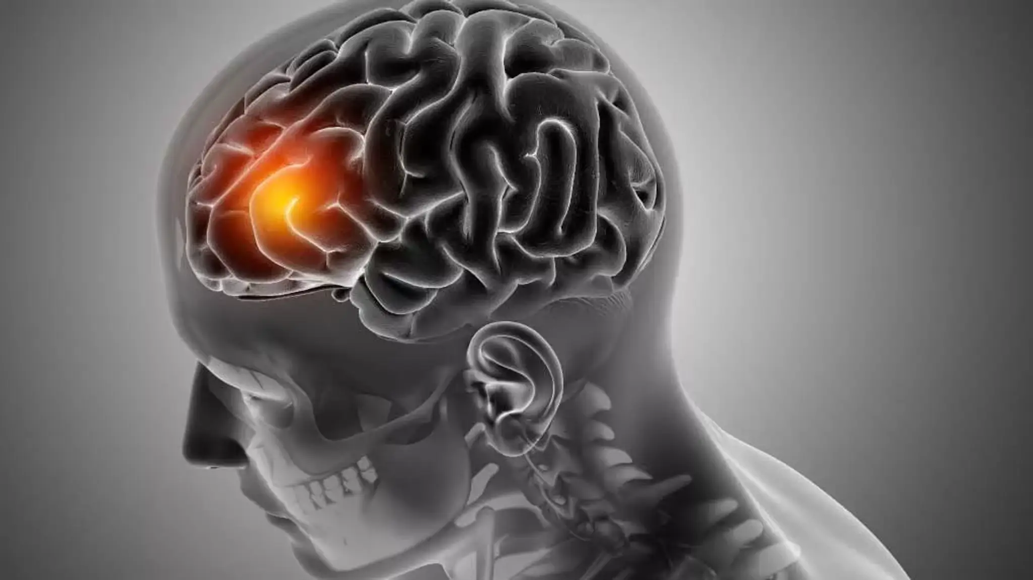 Maurya Stroke Rehabilitation center (Physiotherapy in india)