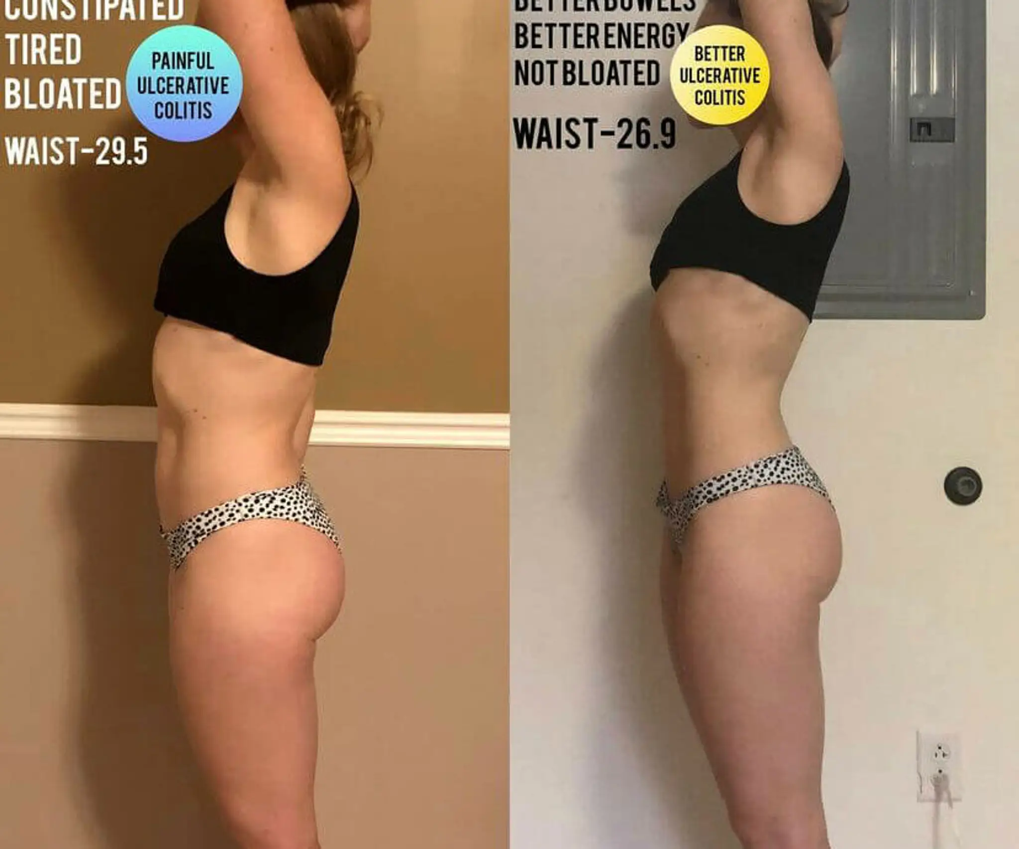 B Elite "Experts in Stress-Reduced Fat Loss"