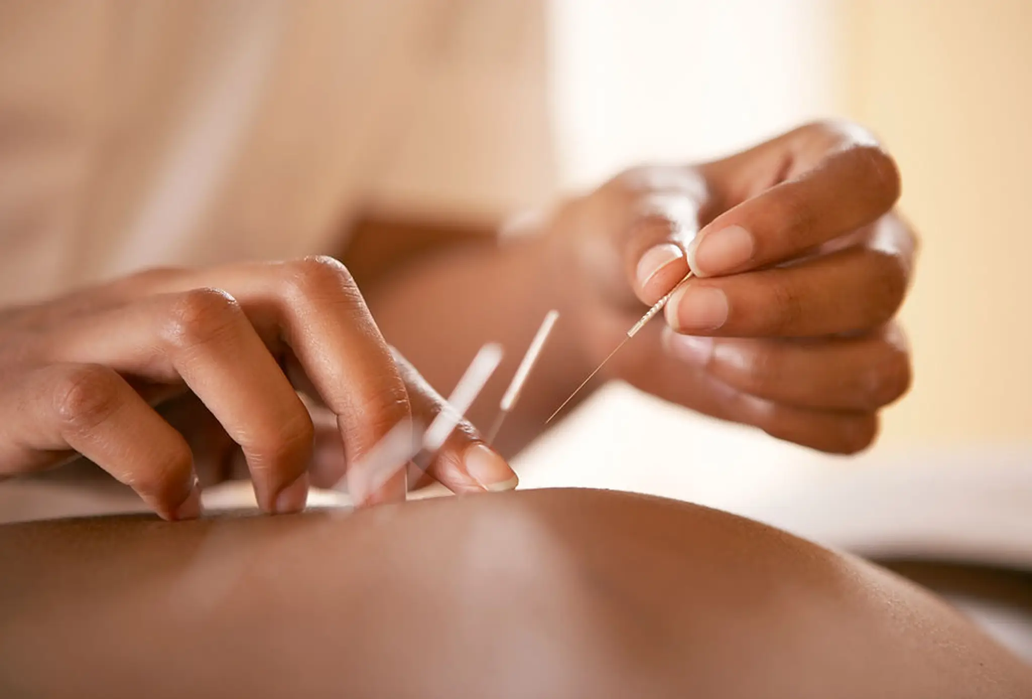 Sports Therapy Stafford