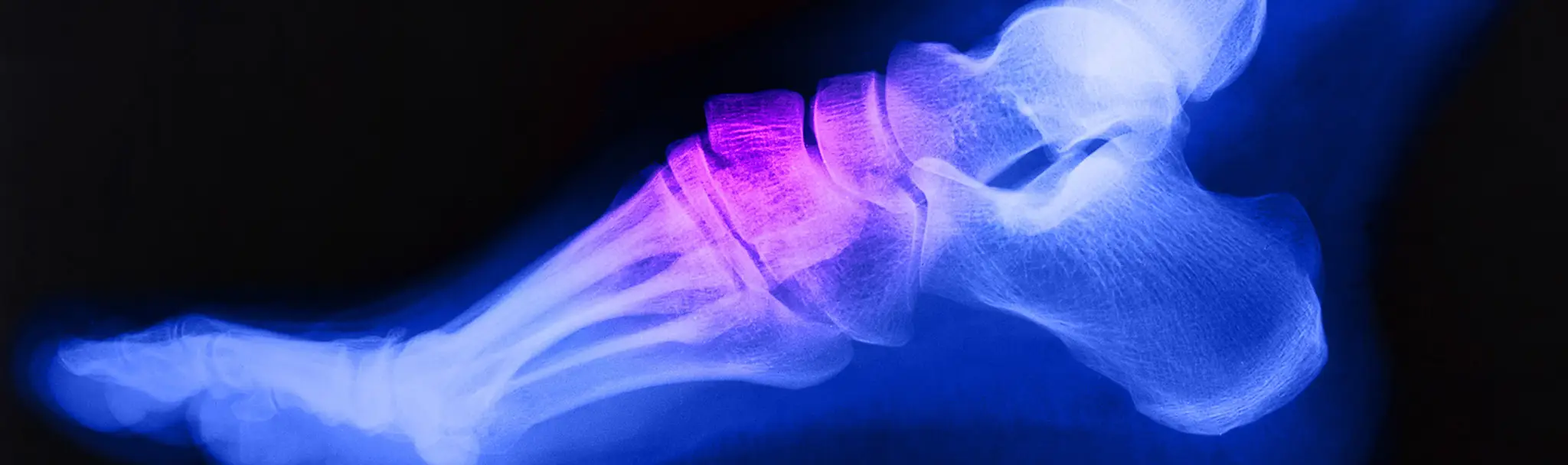 Mountain Physiotherapy