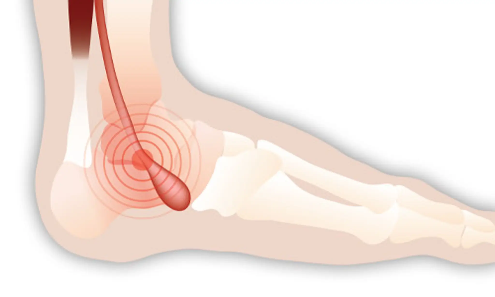 Kelowna Kinesiology By Orthoquest