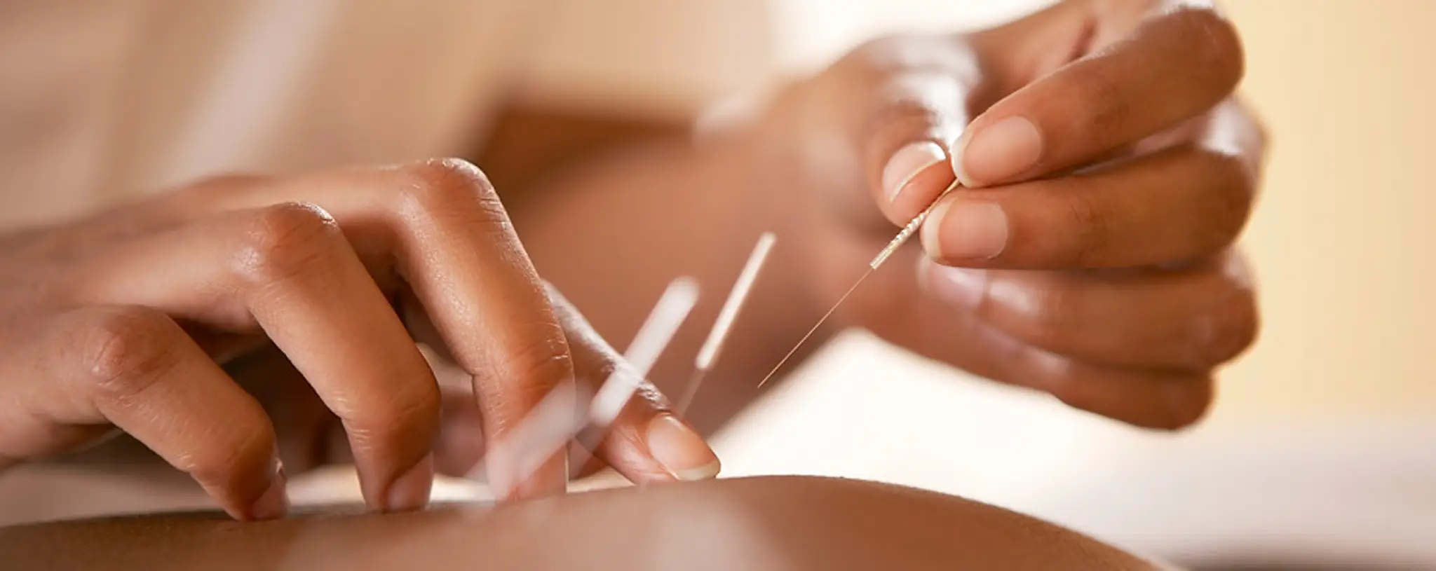 Larissa McGoldrick Acupuncture and Iyengar Yoga