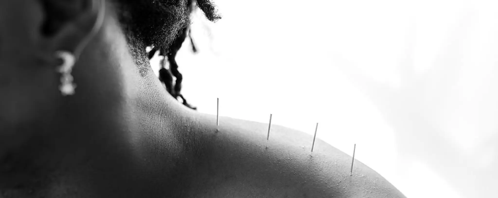 Prehab Exercise & Remedial Massage