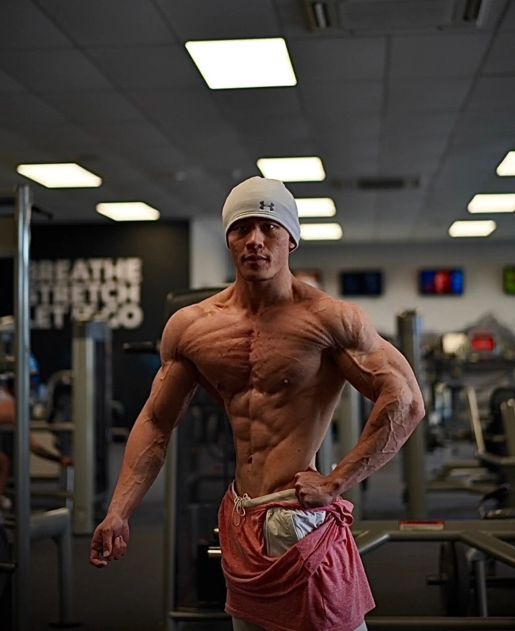 Hyperbolic Fitness