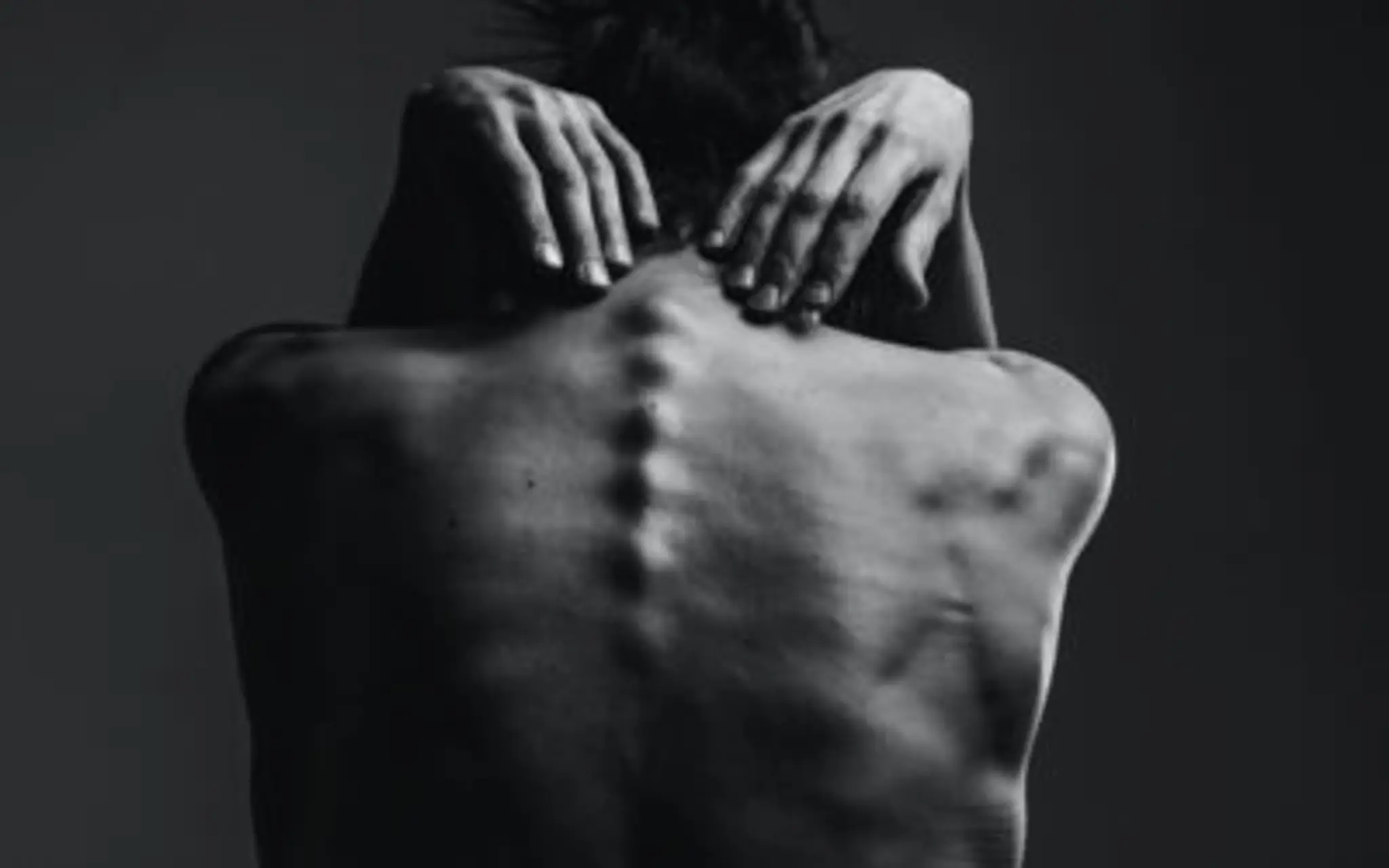 Balanced Bodies: Injury Rehabilitation (Alton)