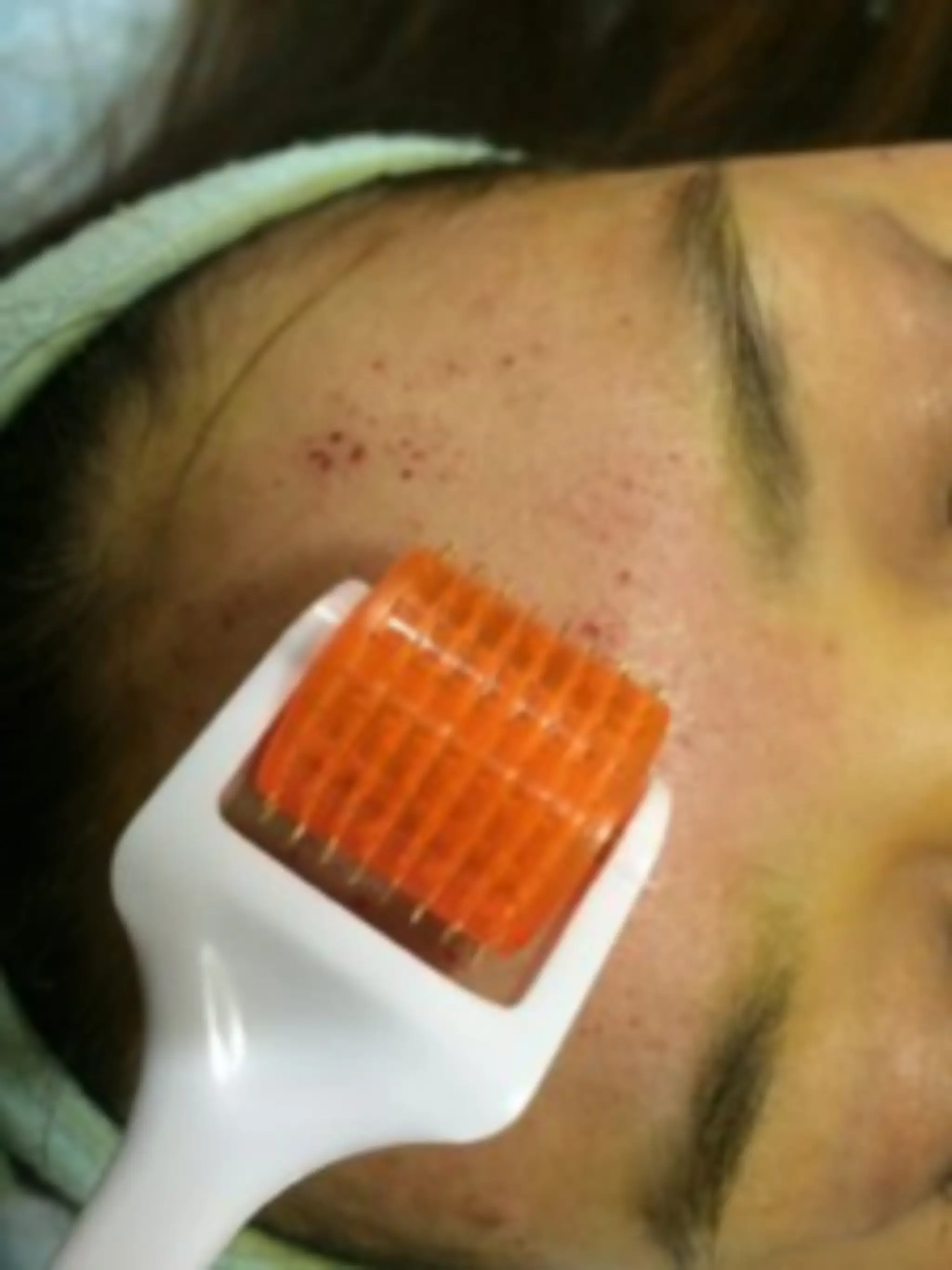 Zolie Skin Clinic - Dermatology & Cosmetology Clinic