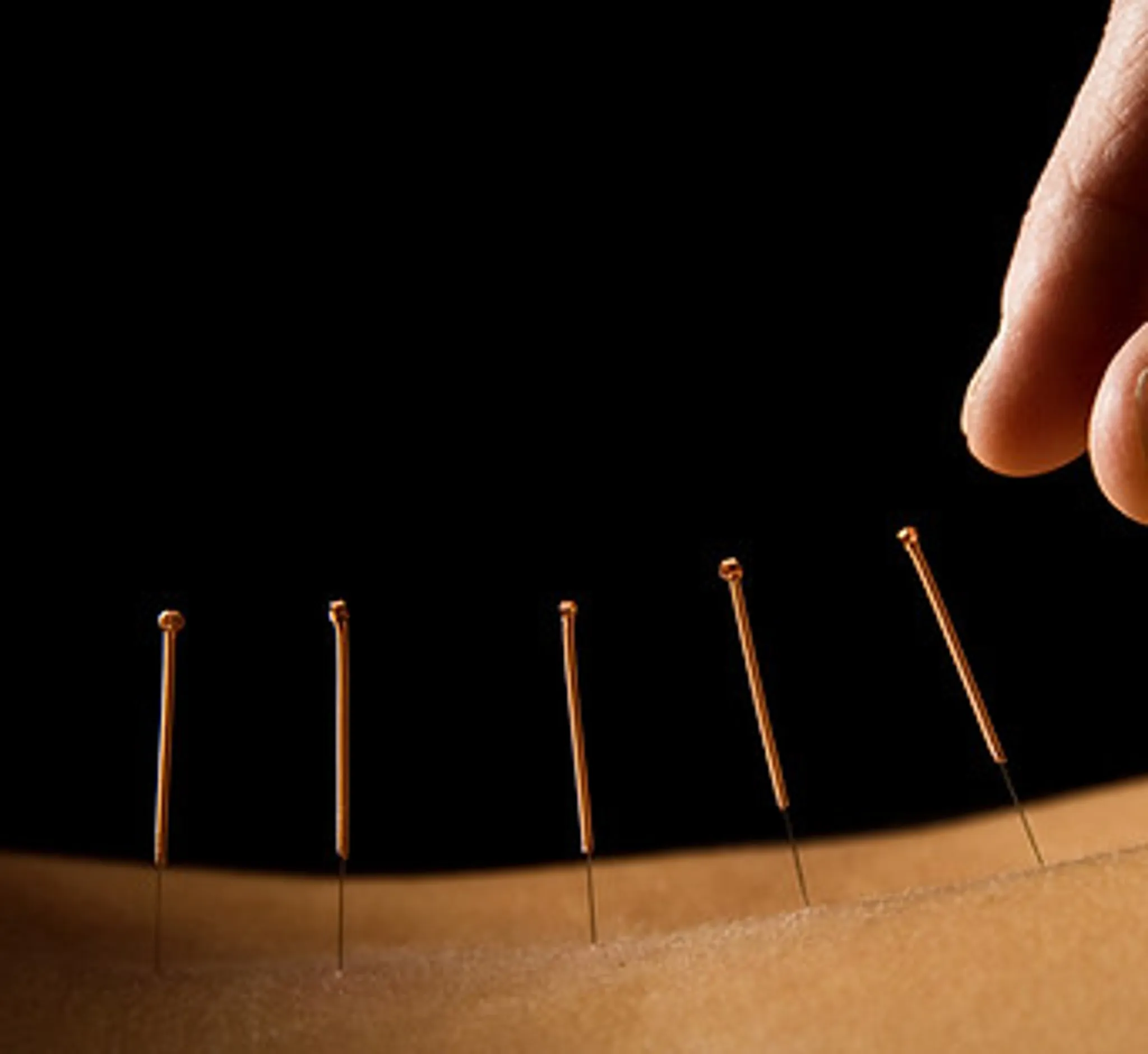 Scott Brisbane - Brunswick Acupuncture, Craniosacral & Yoga