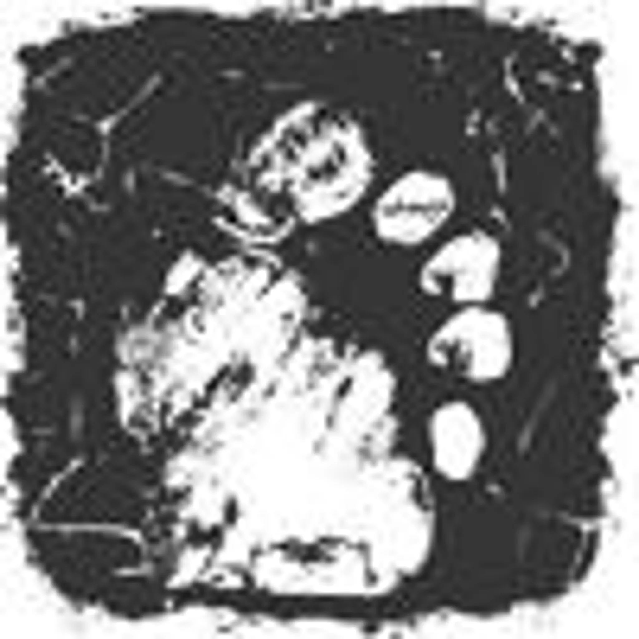 JamFitness Outdoor Training / Garage Gym