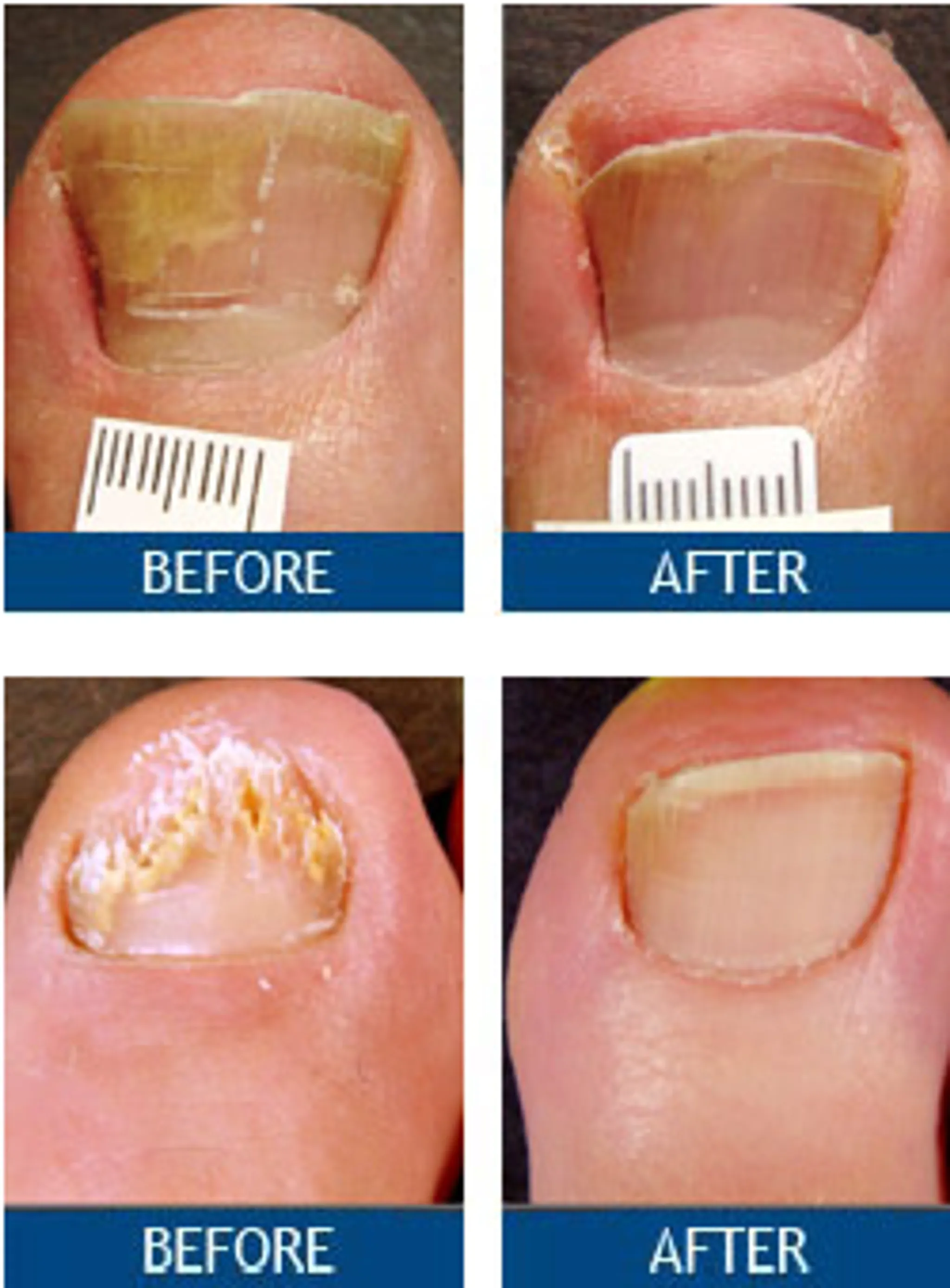 Cancer Rehabilitation Physiotherapy