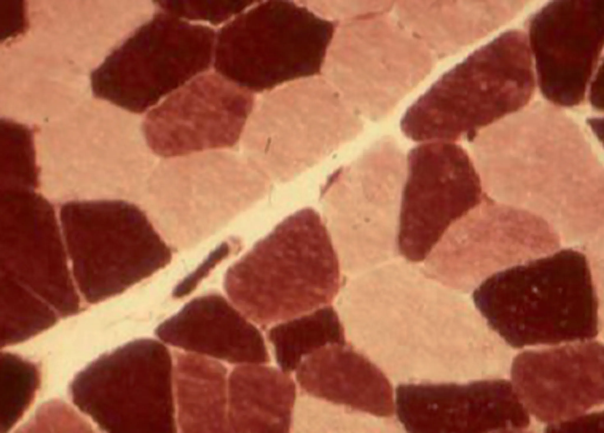 ValeoPerformance - Coach Sportif Toulouse - Mathieu