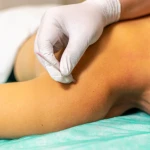 Physio Therapy Centre