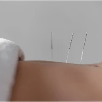 Holistic Physical Recovery & Rehabilitation Centre. Physiotherapy Centre / Acupuncture Centre